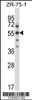 Western blot analysis in ZR-75-1 cell line lysates (35ug/lane) .