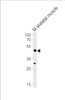 Western blot analysis of lysate from mouse skeletal muscle tissue lysate, using Mouse Hoxc10 Antibody at 1:1000 at each lane.