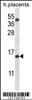 Western blot analysis in human placenta tissue lysates (35ug/lane) .