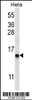 Western blot analysis in Hela cell line lysates (35ug/lane) .