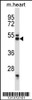 Western blot analysis in mouse heart tissue lysates (35ug/lane) .