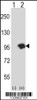 Western blot analysis of USP15 using rabbit polyclonal USP15 Antibody using 293 cell lysates (2 ug/lane) either nontransfected (Lane 1) or transiently transfected (Lane 2) with the USP15 gene.