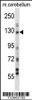 Western blot analysis in mouse cerebellum tissue lysates (35ug/lane) .