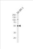 Western blot analysis of lysate from SK-BR-3 cell line, using SMARCE1 Antibody at 1:1000 at each lane.