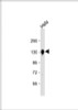 Western Blot at 1:8000 dilution + Hela whole cell lysate Lysates/proteins at 20 ug per lane.