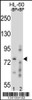 Western blot analysis of RNF40 Antibody Pab pre-incubated without (lane 1) and with (lane 2) blocking peptide in HL-60 cell line lysate.