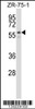 Western blot analysis in ZR-75-1 cell line lysates (35ug/lane) .