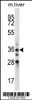 Western blot analysis in mouse liver tissue lysates (35ug/lane) .