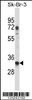 Western blot analysis in SK-BR-3 cell line lysates (35ug/lane) .