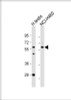 Western Blot at 1:1000 dilution Lane 1: human testis lysate Lane 2: NCI-H460 whole cell lysate Lysates/proteins at 20 ug per lane.