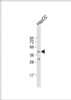 Western Blot at 1:1000 dilution + HepG2 whole cell lysate Lysates/proteins at 20 ug per lane.