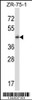 Western blot analysis in ZR-75-1 cell line lysates (35ug/lane) .