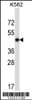 Western blot analysis in K562 cell line lysates (35ug/lane) .