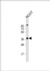 Western Blot at 1:2000 dilution + NCCIT whole cell lysate Lysates/proteins at 20 ug per lane.