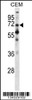 Western blot analysis in CEM cell line lysates (35ug/lane) .