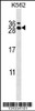 Western blot analysis in K562 cell line lysates (35ug/lane) .