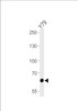 Western blot analysis of lysate from Y79 cell line, using PPEF2 Antibody at 1:1000 at each lane.