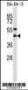 Western blot analysis in SK-BR-3 cell line lysates (35ug/lane) .