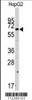 Western blot analysis of anti-SWAP70 Antibody in HepG2 cell line lysates (35ug/lane) . SWAP70 was detected using the purified polyclonal antibody.