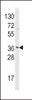 Western blot analysis of HNMT Antibody in Hela cell line lysates (35ug/lane) . HNMT was detected using the purified polyclonal antibody.