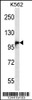 Western blot analysis in K562 cell line lysates (35ug/lane) .