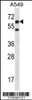 Western blot analysis in A549 cell line lysates (35ug/lane) .