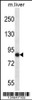 Western blot analysis in mouse liver tissue lysates (35ug/lane) .