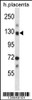 Western blot analysis in human placenta tissue lysates (35ug/lane) .