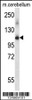 Western blot analysis in mouse cerebellum tissue lysates (35ug/lane) .