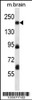 Western blot analysis in mouse brain tissue lysates (35ug/lane) .