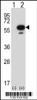 Western blot analysis of Stk25 using rabbit polyclonal Mouse Stk25 Antibody using 293 cell lysates (2 ug/lane) either nontransfected (Lane 1) or transiently transfected (Lane 2) with the Stk25 gene.