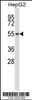 Western blot analysis in HepG2 cell line lysates (35ug/lane) .