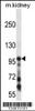 Western blot analysis in mouse kidney tissue lysates (35ug/lane) .