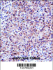 CELA3A Antibody immunohistochemistry analysis in formalin fixed and paraffin embedded human pancreas tissue followed by peroxidase conjugation of the secondary antibody and DAB staining.