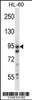 Western blot analysis in HL-60 cell line lysates (35ug/lane) .