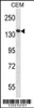 Western blot analysis in CEM cell line lysates (35ug/lane) .