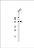 Western Blot at 1:1000 dilution + K562 whole cell lysate Lysates/proteins at 20 ug per lane.