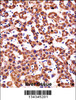 CYP2D6 Antibody immunohistochemistry analysis in formalin fixed and paraffin embedded human liver tissue followed by peroxidase conjugation of the secondary antibody and DAB staining.