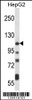 Western blot analysis in HepG2 cell line lysates (35ug/lane) .