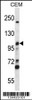 Western blot analysis in CEM cell line lysates (35ug/lane) .