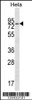 Western blot analysis in Hela cell line lysates (35ug/lane) .