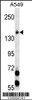 Western blot analysis in A549 cell line lysates (35ug/lane) .