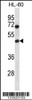 Western blot analysis in HL-60 cell line lysates (35ug/lane) .