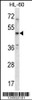 Western blot analysis in HL-60 cell line lysates (35ug/lane) .