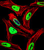 Fluorescent confocal image of Hela cell stained with EWSR1 Antibody .Hela cells were fixed with 4% PFA (20 min) , permeabilized with Triton X-100 (0.1%, 10 min) , then incubated with EWSR1 primary antibody (1:25) . For secondary antibody, Alexa Fluor 488 conjugated donkey anti-rabbit antibody (green) was used (1:400) .Cytoplasmic actin was counterstained with Alexa Fluor 555 (red) conjugated Phalloidin (7units/ml) . Nuclei were counterstained with DAPI (blue) (10 ug/ml, 10 min) .EWSR1 immunoreactivity is localized to Nucleus significantly.