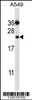 Western blot analysis in A549 cell line lysates (35ug/lane) .