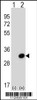 Western blot analysis of *SCGN using rabbit polyclonal *SCGN Antibody using 293 cell lysates (2 ug/lane) either nontransfected (Lane 1) or transiently transfected (Lane 2) with the SCGN gene.