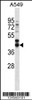 Western blot analysis in A549 cell line lysates (35ug/lane) .