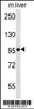 Western blot analysis in mouse liver tissue lysates (35ug/lane) .