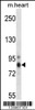 Western blot analysis in mouse heart tissue lysates (35ug/lane) .